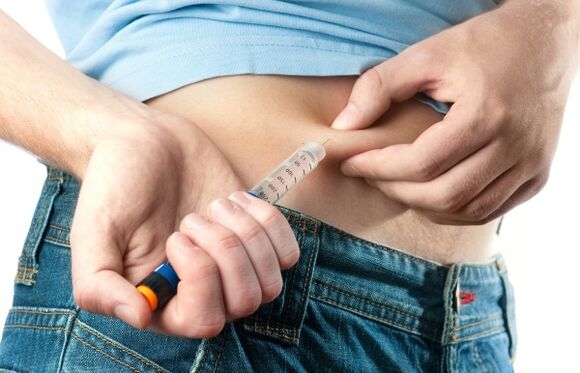 Il diabete di tipo 2 grave richiede la somministrazione di insulina